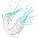 Συσκευασία 50 τεμαχίων για τη χρήση νήματος οδοντιατρικής για σιδεράκια και μεσοδόντια καθαριστικά από λευκή πλαστική ίνα για στοματική υγιεινή 1