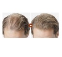 Ulei pentru cresterea parului 30 ml 2