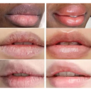 Verhelderende lippenbalsem 10 g met niacinamide Hydraterende lipverzorging Voedende balsem tegen pigmentatie Zachte regeneratie van de lippen 2
