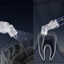 Zębowe endodontyczne igły irygacyjne 30 szt. 0,3 mm końcówki strzykawkowe do czyszczenia kanałów korzeniowych narzędzia dentystyczne dla stomatologii 4