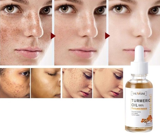 Hudolja mot pigmentfläckar 30 ml