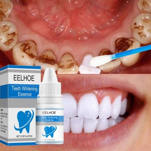 Hampaidenvalkaisuaine 10 ml