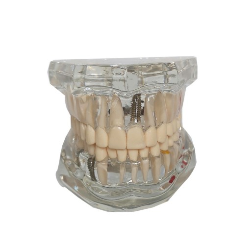 Modèle transparent de la dentition humaine