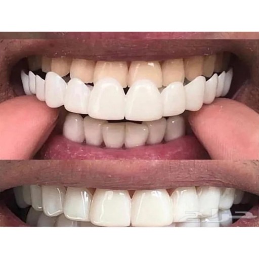 Prothèse dentaire en gel de silicone souple Dents du haut Prothèse dentaire temporaire Prothèse esthétique Sourire blanc Application facile